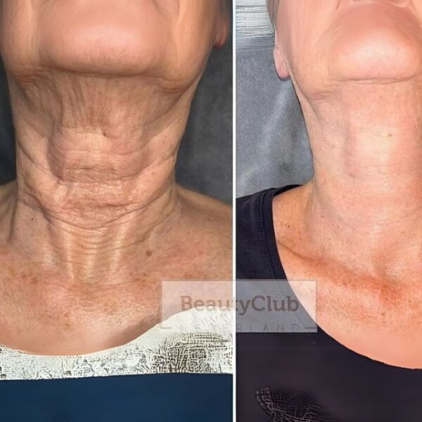 Korean Neck Lift Cream