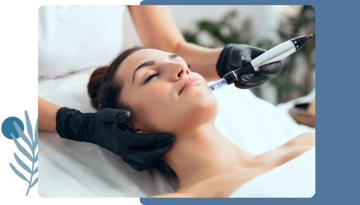 Skin Microneedling service in Chelmsford London