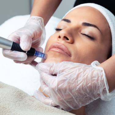 Salmon DNA Ampoule Treatment in Chelmsford London `