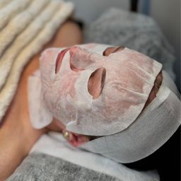 Fire and Ice Facial in Chelmsford London